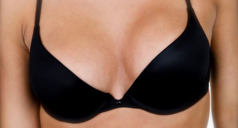 uneven breasts surgery before and after