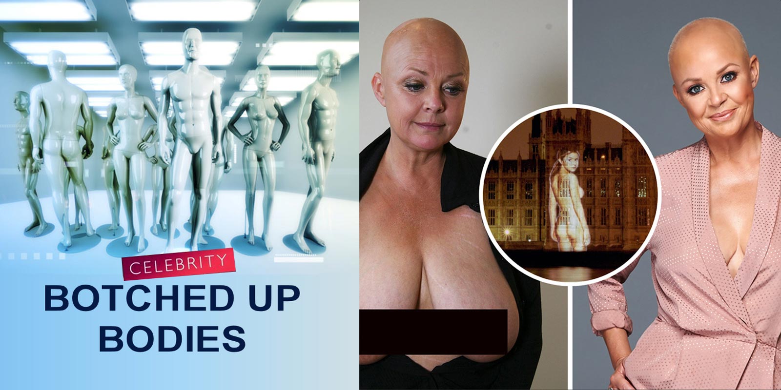Botched up Bodies Television & Radio Top Surgeons breast surgery paul harris plastic surgeon breast surgeon london